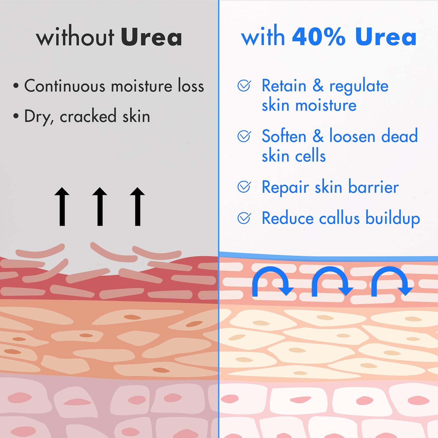 Ebanel Urea Cream 40% plus Salicylic Acid 2%, Foot Cream for Dry Cracked Heels Feet Knees Elbows Hands, Foot Dead Skin Cuticle Callus Remover Toenail Softener, Keratolytic Skin Barrier Repair - Image 6