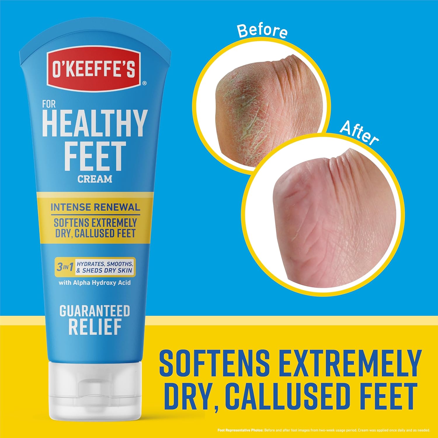 O'Keeffe's for Healthy Feet Intense Renewal Cream with Alpha Hydroxy Acid - 3 oz Tube (1 Pack) - Softens and Exfoliates Extremely Callused, Dry Feet - Image 3